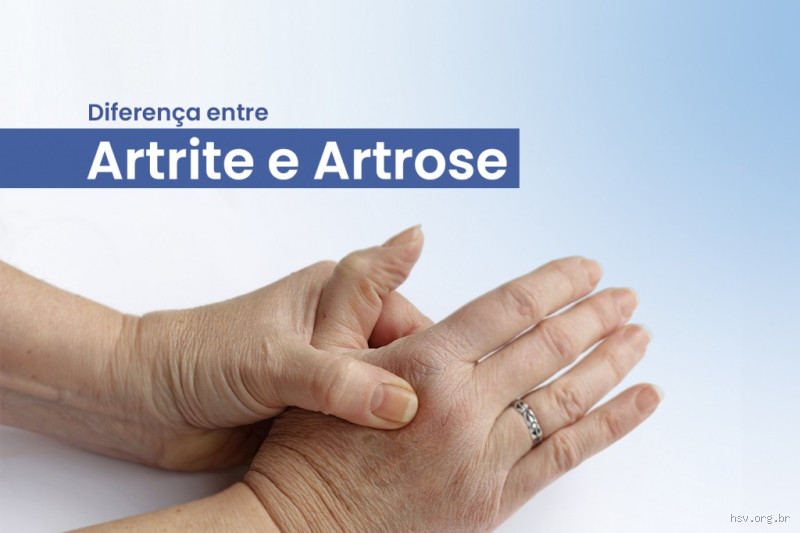 Como descobrir se você tem artrite ou artrose?