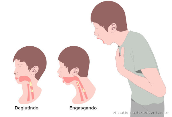 Como reconhecer os sinais de engasgo? Saiba o que fazer!