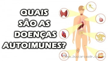 Como saber se a doença autoimune está ativa? Sinais e Sintomas Importantes