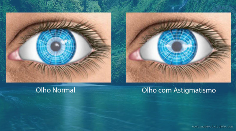 O Astigmatismo Está Piorando? Reconheça os Sinais e Tome Medidas!"