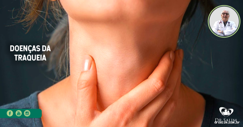 O que causa inflamação na traqueia? Entenda as principais causas