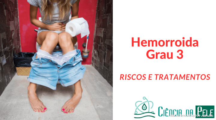 O que é hemorroida grau 3?