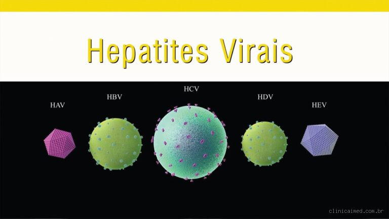 Hepatite Viral: Tem Cura? Tudo o que Você Precisa Saber