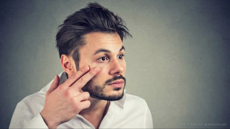 O que fazer para tirar o inchaço do olho?