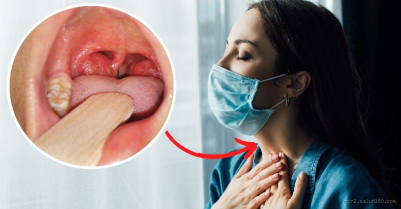 Pode comer pão com a garganta inflamada? Descubra agora!