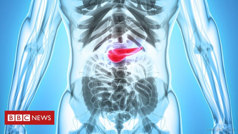 Por que câncer no pâncreas é fatal? Descubra os motivos
