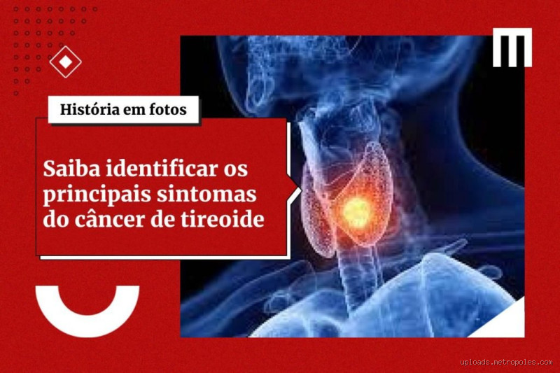 Quais são os sintomas do câncer de tireoide? Descubra os sinais importantes