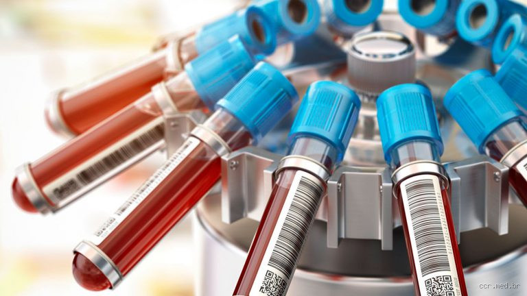 Qual exame de sangue detecta o estresse? Entenda os testes mais eficazes