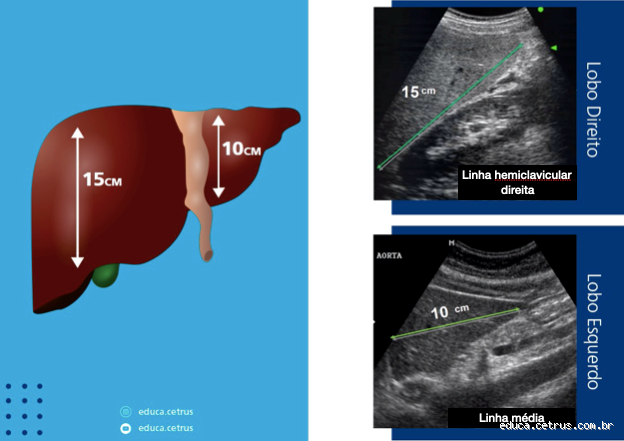 Qual É o Exame Ideal para Avaliar a Saúde do Fígado? Descubra os Testes Essenciais