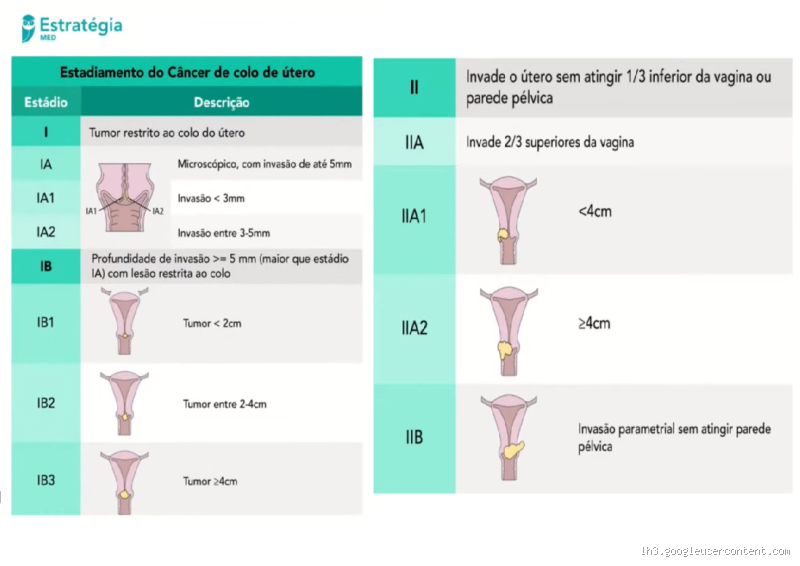 Qual o tratamento mais indicado para casos de câncer de colo de útero?