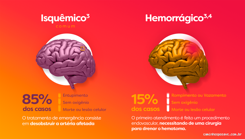 Quem teve AVC fica esquecido? Entenda os Efeitos e Possíveis Consequências