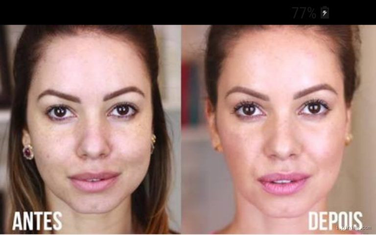 Sou magro mas meu rosto é redondo? Descubra o que pode estar acontecendo