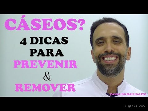 O que fazer para evitar cáseos? Dicas reais para acabar com essas pedrinhas incômodas