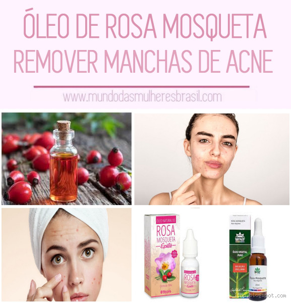 Quantas gotas de óleo de rosa mosqueta colocar no creme? Descubra a medida ideal